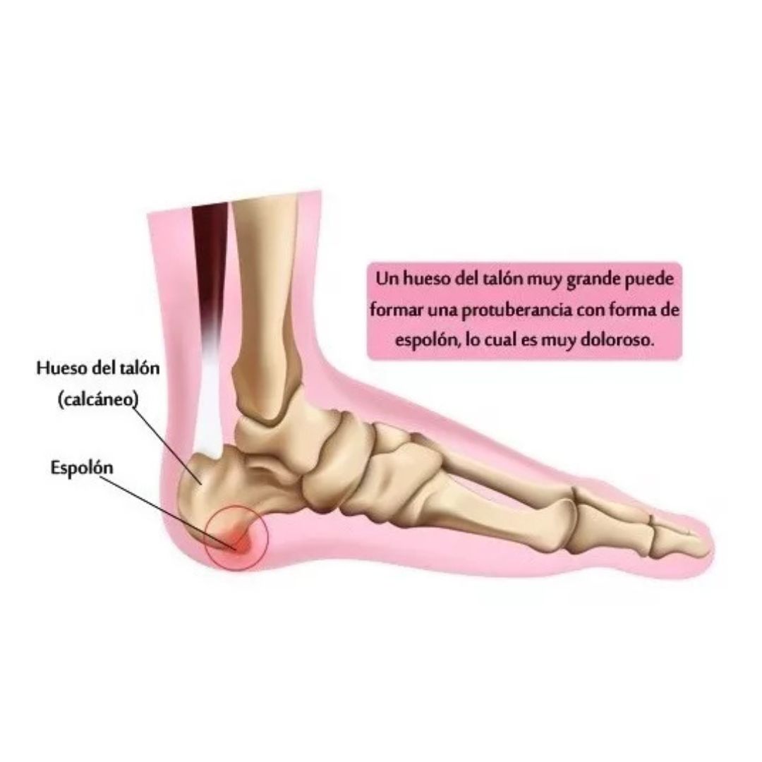 Plantillas Ortopédicas de Alto Rendimiento | Soporte y Confort Diario